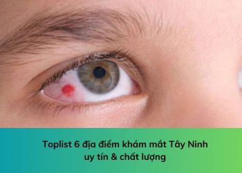 Toplist 6 địa điểm khám mắt Tây Ninh uy tín & chất lượng